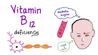 Vitamin B12 Cobalamin Deficiency  Causes Symptoms Diagnosis amp Management  Hematology Series [upl. by Eveam345]