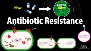 Antibiotic Resistance Animation [upl. by Ballinger]