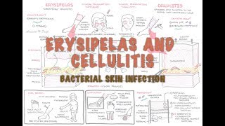 Bacterial Skin Infection  Cellulitis and Erysipelas Clinical Presentation Pathology Treatment [upl. by Mundt]