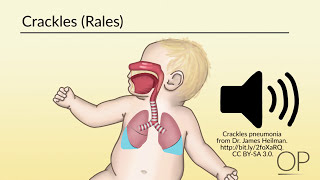 Respiratory Assessment by B Leary L DelSignore  OPENPediatrics [upl. by Amy]