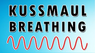 Kussmauls Breathing Pattern Causes Sound and Treatment [upl. by Akkahs]