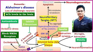 Alzheimers disease and its treatment Donepezil Memantine [upl. by Anitra]