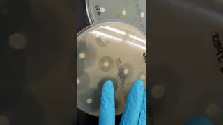 Microbiology Antibiotic Susceptibility Resistance and ESBL Part 1 [upl. by Lundin]