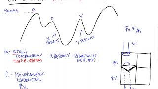 CVP Tracing [upl. by Onitsoga668]