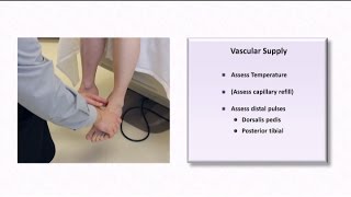 The Diabetic Foot Exam [upl. by Eniaj548]