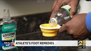 How to help knock out Athletes Foot [upl. by Lierbag]