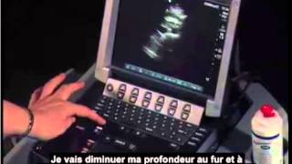 Echographie pelvienne abdominale mammaire  les principes [upl. by Higinbotham]