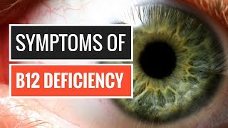 5 Signs and Symptoms of Vitamin B12 Deficiency [upl. by Niraj108]