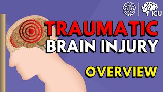 Overview of Traumatic Brain Injury TBI [upl. by Alastair305]