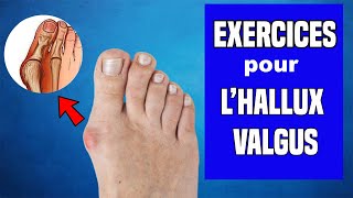 HALLUX VALGUS  TRAITEMENT ET EXERCICES KINÉ [upl. by Mindy]